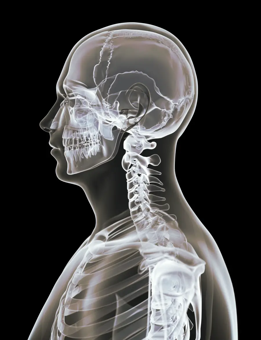 Torcicolo e bloqueio cervical - osteopatia em Paris 6