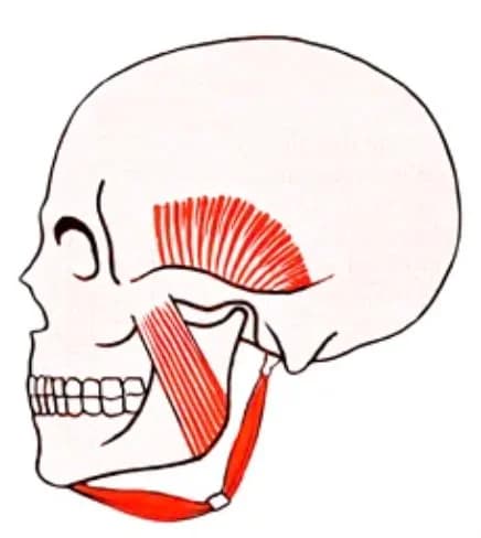Muscle masséter et douleurs de la mâchoire